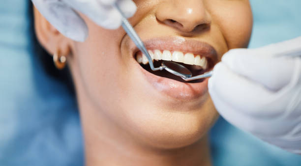Best Emergency Tooth Extraction in Mcrae Helena, GA