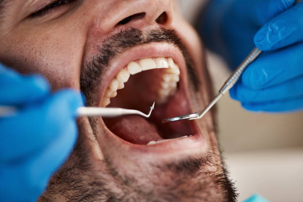 Best Emergency Tooth Extraction in Mcrae Helena, GA
