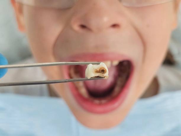 Best Emergency Dental Care for Broken or Chipped Teeth in Mcrae Helena, GA