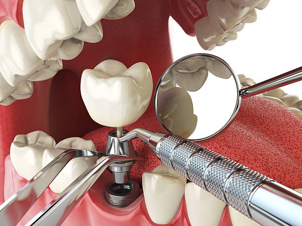 Best Emergency Denture Repair in Mcrae Helena, GA